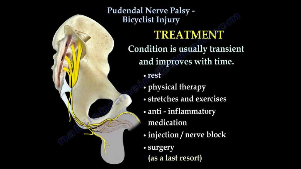 Pudendal Nerve Entrapment Syndromes Physiotherapy Treatment Exercise