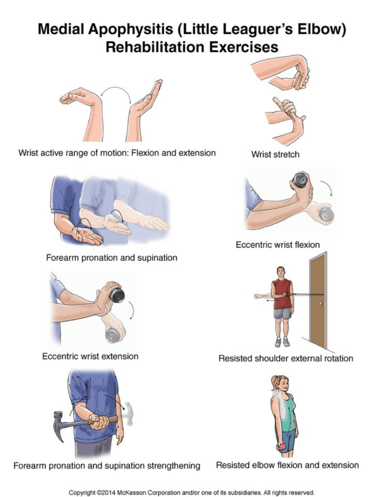 Little League Elbow : Physiotherapy Treatment, Exercise