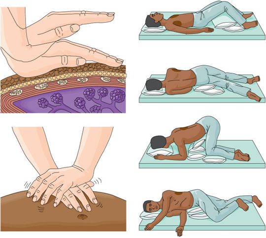 chest physiotherapy treatment