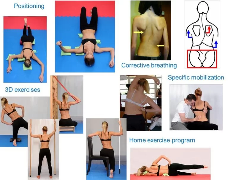 Physiotherapy Exercises For The