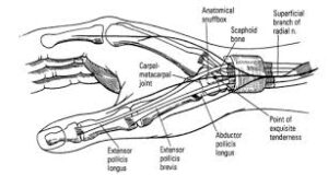 Kinesiotapping for De-Quervain Disease