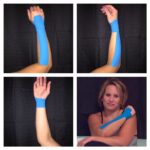 kinesio tapping for wrist sprain