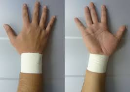 KINESIO TAPPING FOR WRIST SPRAIN : KT Taping