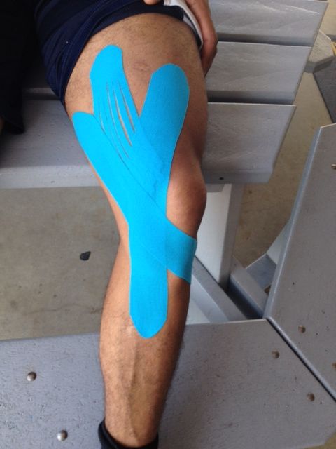 kinesio-taping-for-mcl-tear