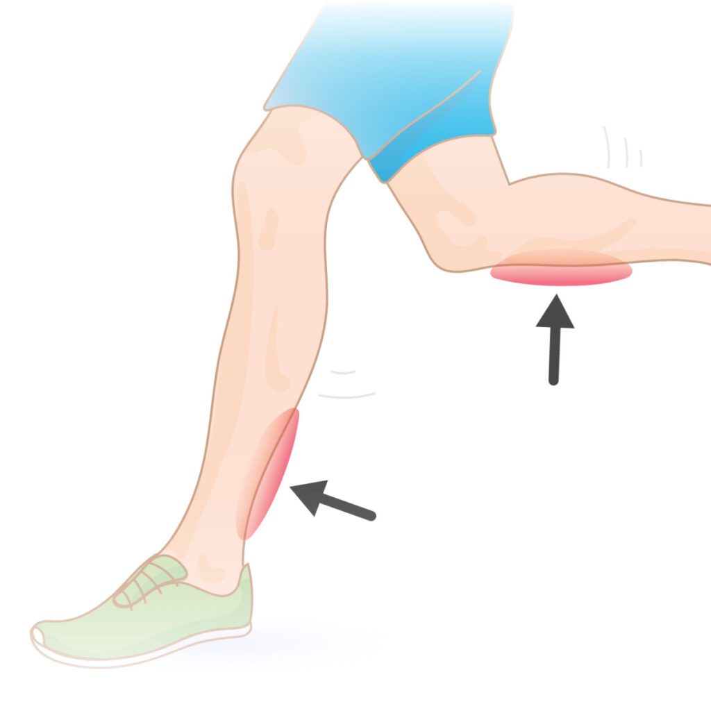 Calf Pain Cause Symptoms Diagnosis Treatment Exercise Samarpan