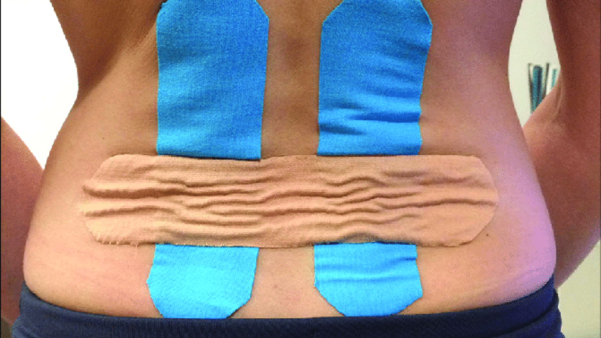 TAPING TECHNIQUE FOR BACK PAIN - Samarpan Physiotherapy clinic