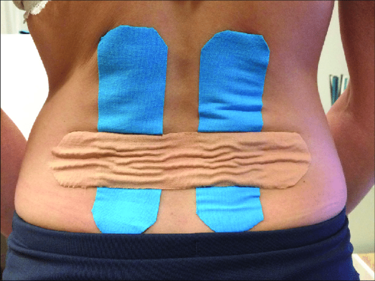 Effects of Kinesiology Taping for Pain, Disability, and Performance
