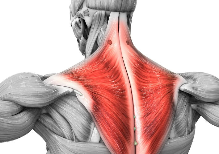 trapezius muscle exercise pain