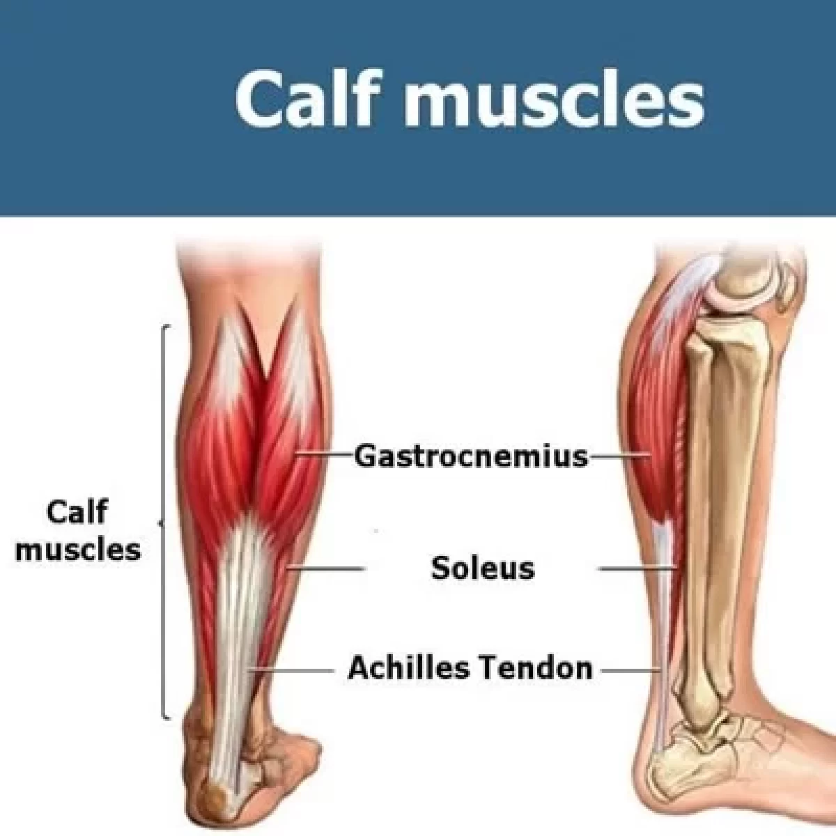 A calf strain can occur in either your gastrocnemius or soleus