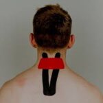 TAPING TECHNIQUE FOR NECK PAIN Samarpan Physiotherapy Clinic