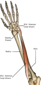 Extensor carpi ulnaris (ECU) tendon strain
