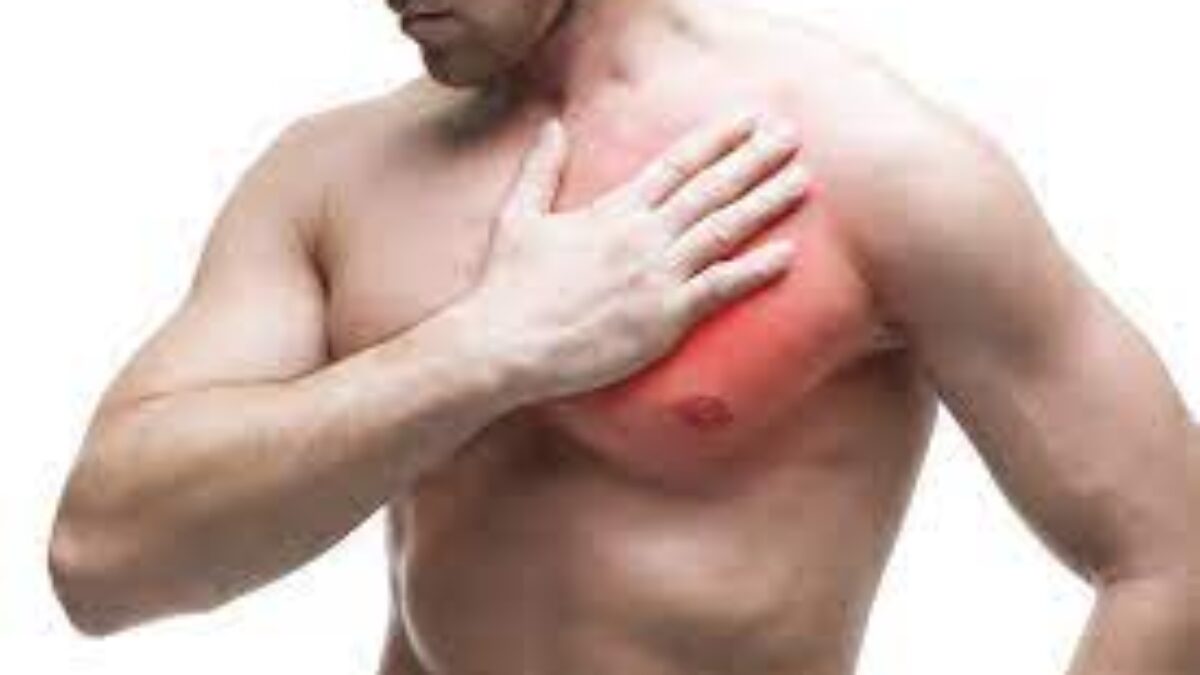 How Do I Treat Sore Chest Muscles?