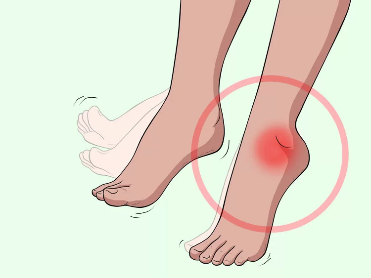 Foot Drag / Foot Drop? Dragging Leg While Walking? - CORE Therapy & Pilates