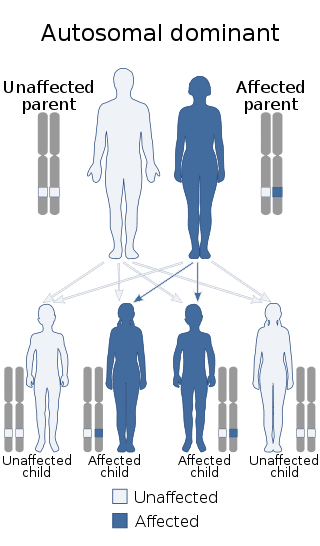 Costello syndrome is inherited in an autosomal dominant manner