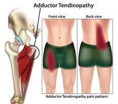 Atelectasis - Types, Cause, Symptoms, Diagnosis, Treatment