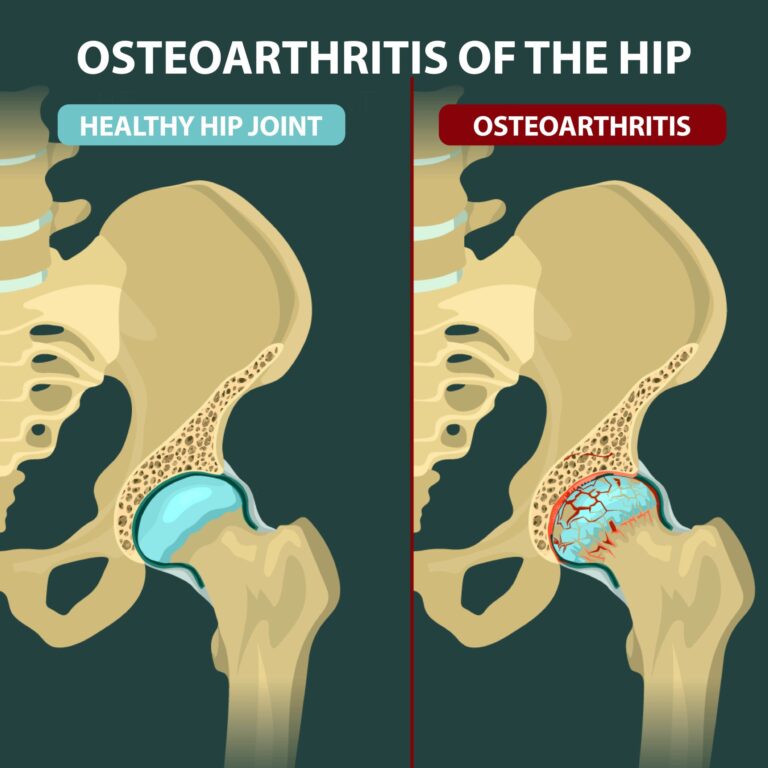 case-study-cardiac-manifestations-of-rheumatoid-arthritis