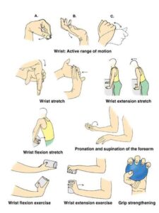 Limb-Girdle Muscular Dystrophy (LGMD) Symptoms, Treatment