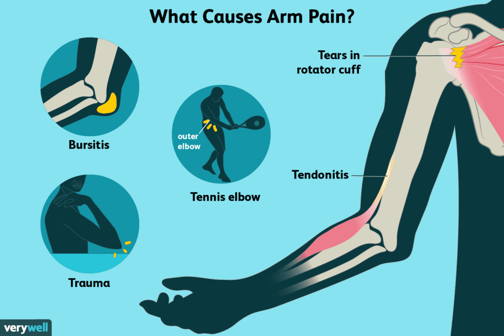 causes of arm muscle pain