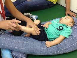 treatment of microcephaly