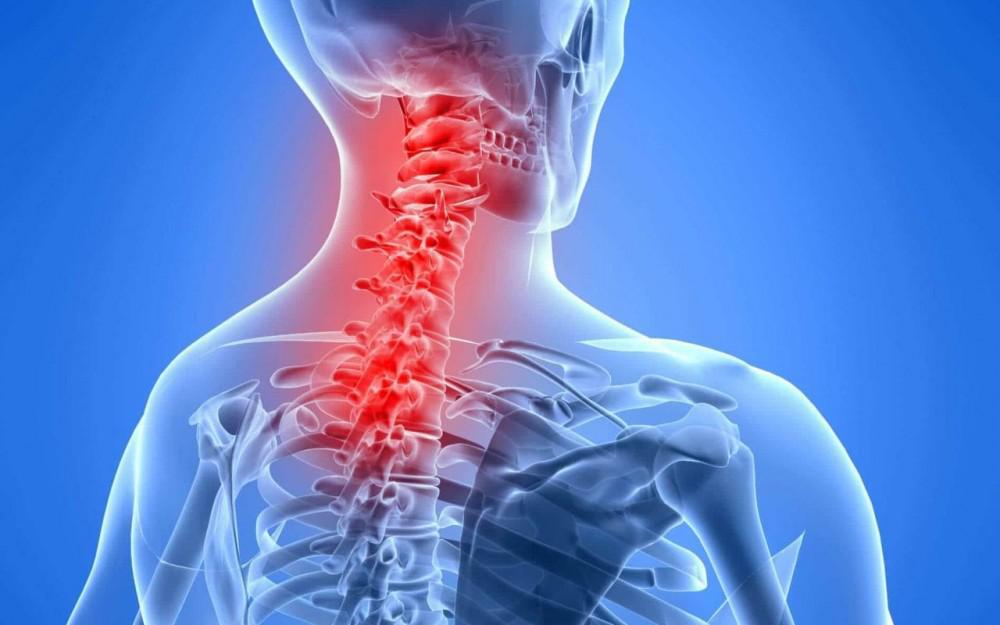 Neck muscle strain - Cause, Symptoms, Treatment, Exercise