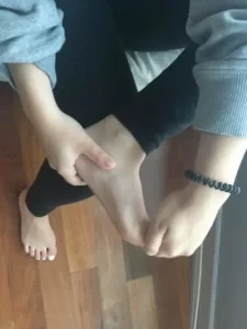 Ankle Toe Extension