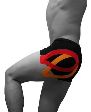 application of Kinesio tape on hip pain