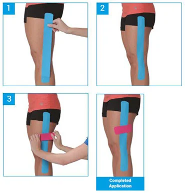 KT Tape - Hip or IT Band pain? Check out the IT Band Hip #kttape  application. Check out the how-to video here:  .com/instructions/it-band-hip/ Looking for more support & sticking power?  Use full
