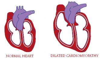 Ed cardiac block conduction