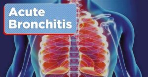 Acute bronchitis - Cause, Symptoms, Diagnosis, Treatment