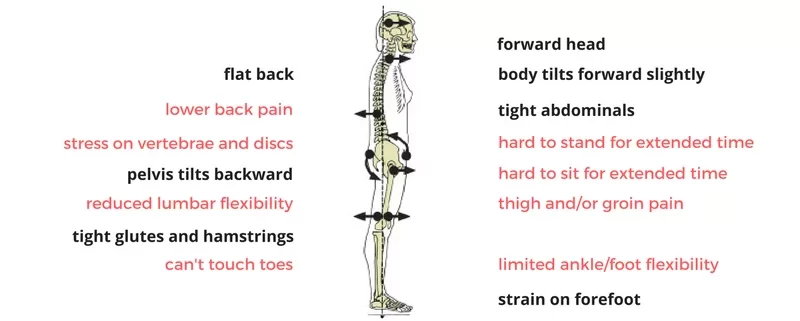 Pilates Exercises For Flat Back Posture Archives Samarpan