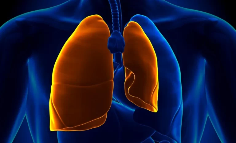 Pneumothorax