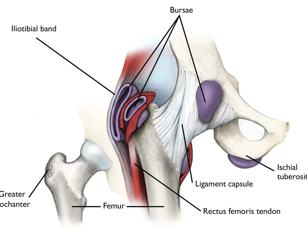 Snapping hip syndrome - Cause, Symptoms, Treatment, Exercise