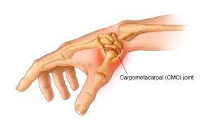 cmc joint of thumb
