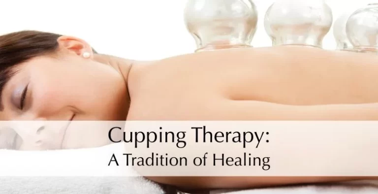 Cupping Therapy