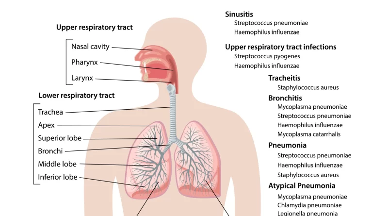 upper-respiratory-tract-infection-ppt-archives-samarpan-physiotherapy