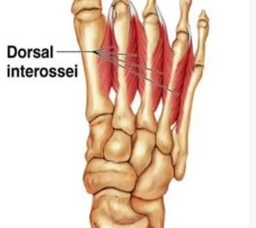 Dorsal Interossei Foot Archives Samarpan Physiotherapy Clinic Ahmedabad 0046