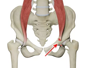 Iliopsoas Tendonitis - Cause, Symptoms, Treatment, Exercise