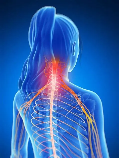 Cervical Radiculopathy Cause Symptoms Treatment Exercise   Cervical Aa.webp