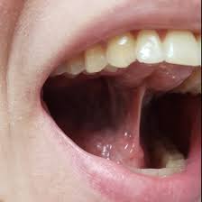 reverse tongue breathe
