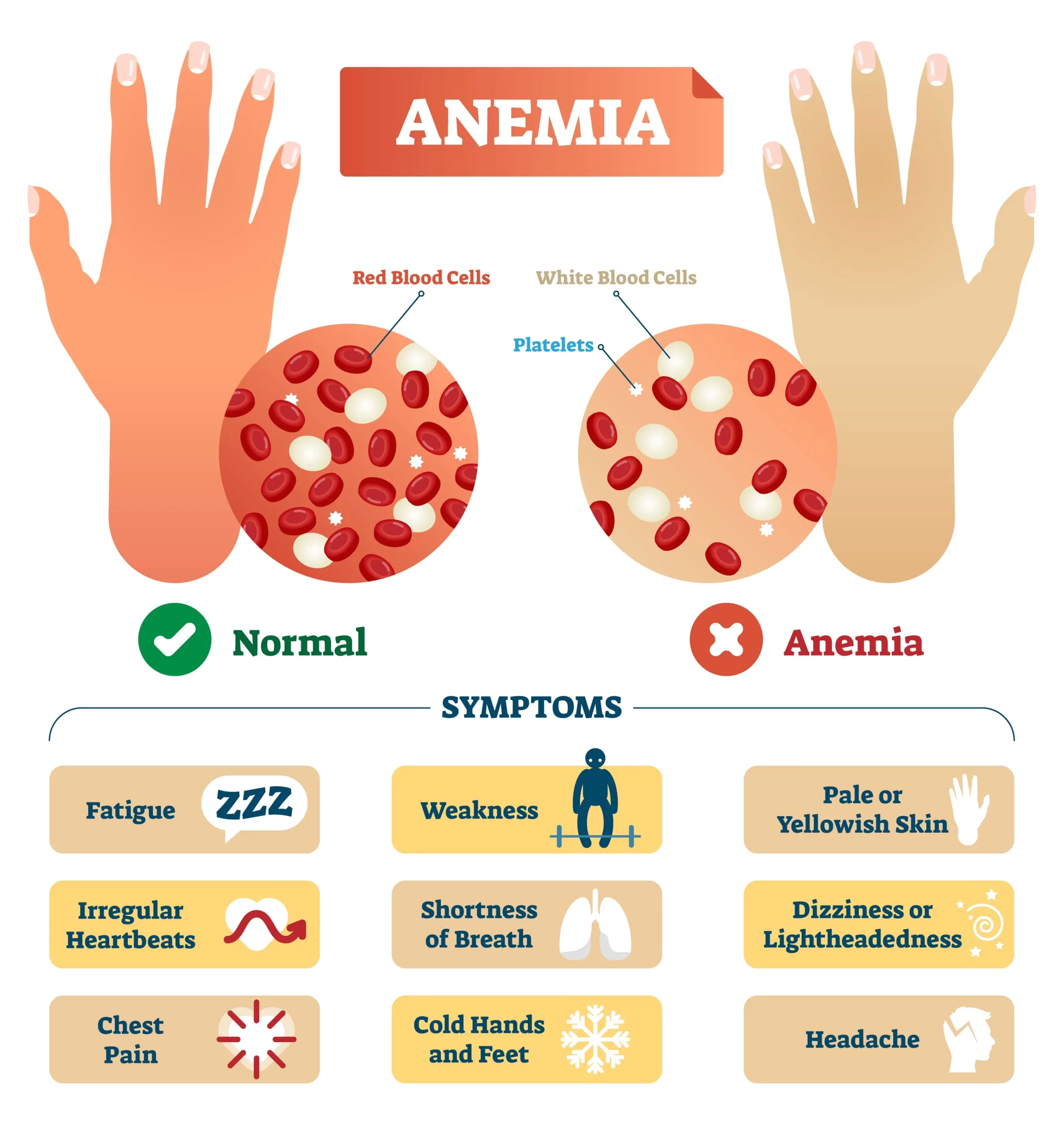 Anemia Cause Symptoms Diagnosis Treatment Mobile Physio