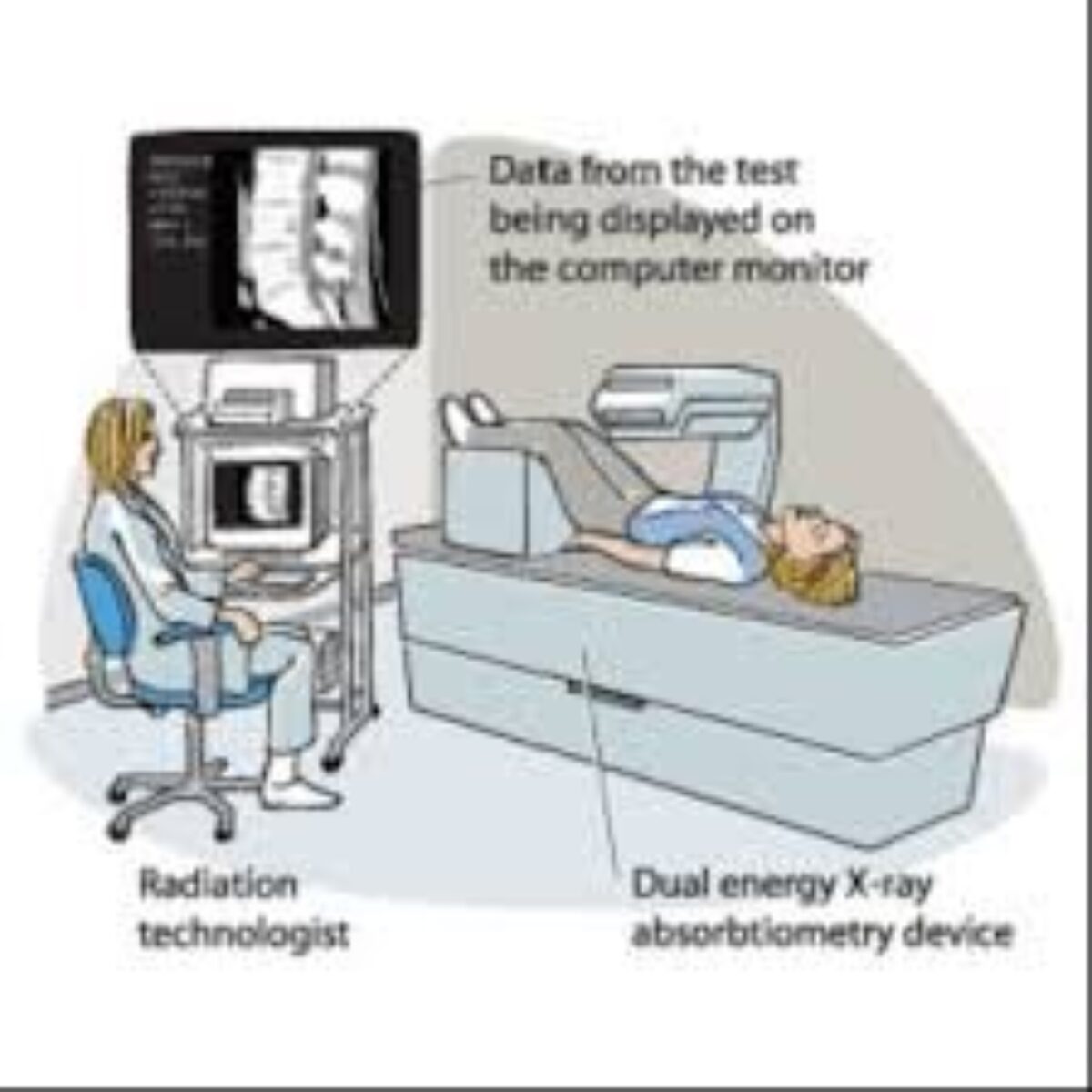 Radiation in Healthcare: Bone Density (DEXA Scan), Radiation, NCEH