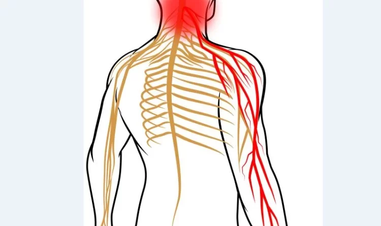 pinched-nerve-in-neck-neurological-symptoms-archives-samarpan