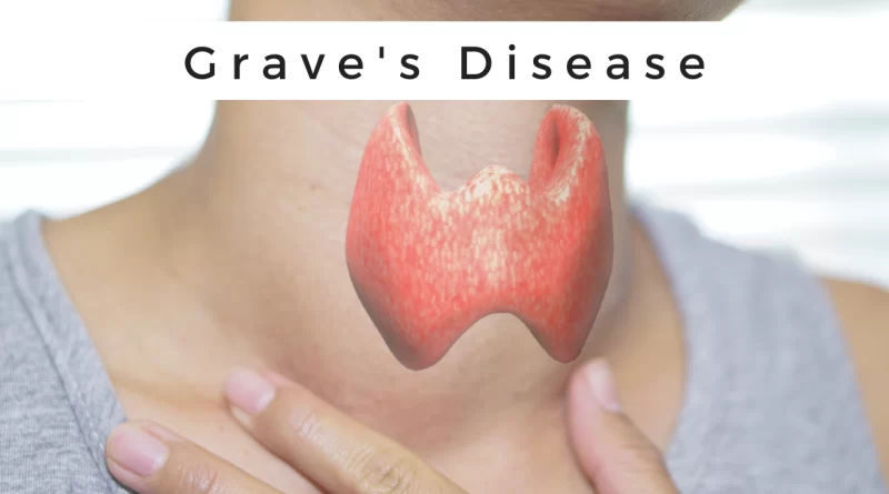 graves-disease-surgery-archives-samarpan-physiotherapy-clinic-ahmedabad