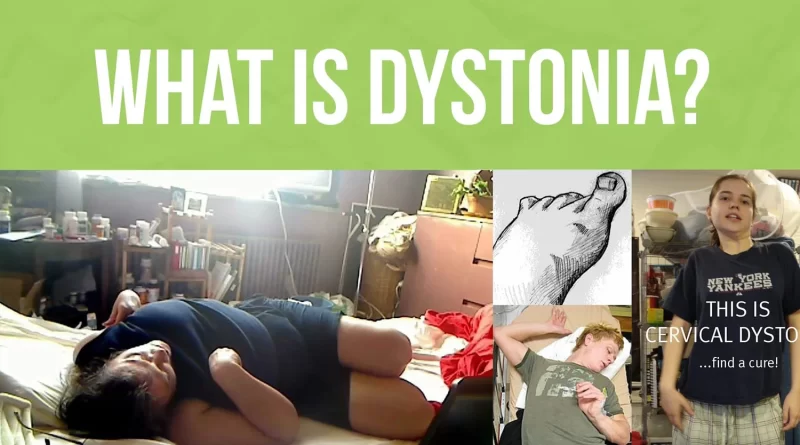 Foods To Avoid With Dystonia Archives - SAMARPAN PHYSIOTHERAPY CLINIC ...