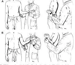 External rotation lag sign