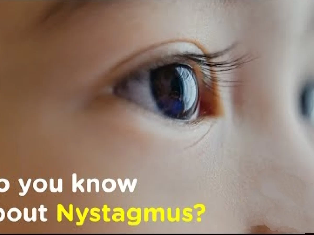 Nystagmus - Types, Causes, Symptoms, Treatment, Exercise