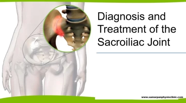 Sacroiliitis