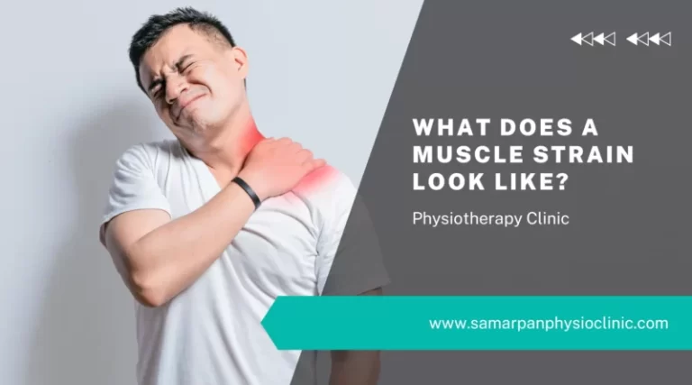 Costoclavicular Syndrome - Symptoms, Treatment - Samarpan