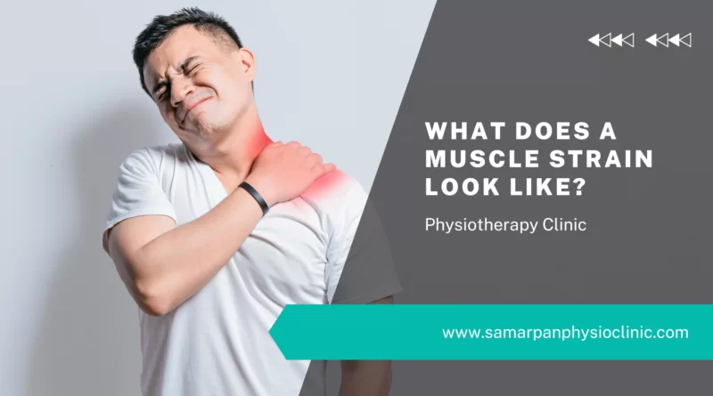 what-does-a-muscle-strain-look-like-samarpan-physio