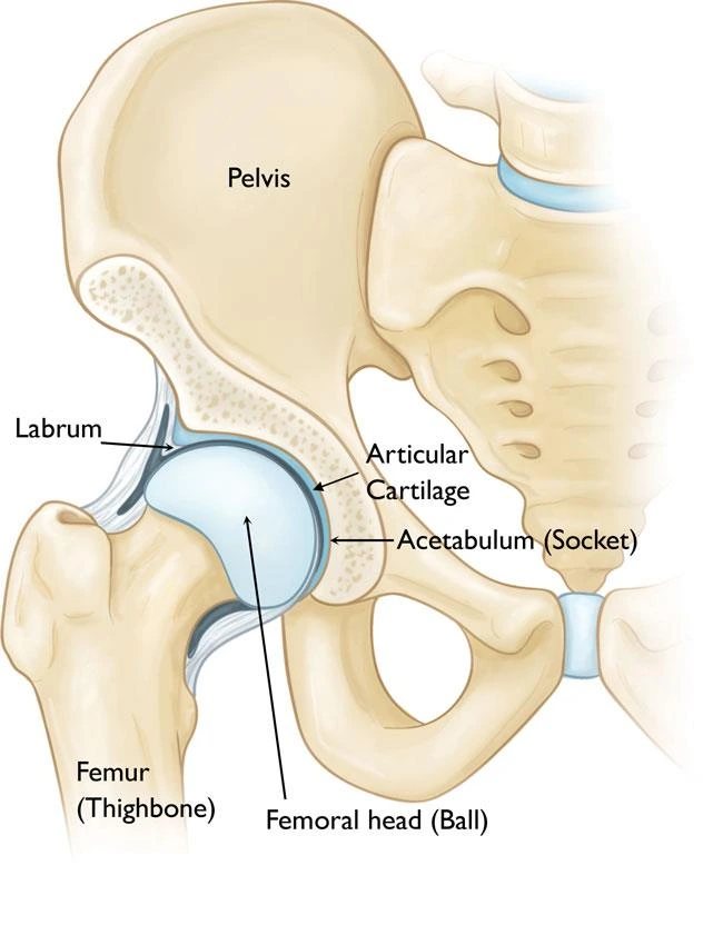 Adolescent hip dysplasia